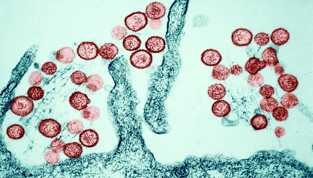 Brote de hantavirus mantiene en alerta a EE.UU.: Un primer positivo y varios casos sospechosos en cuarentena