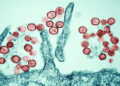 Brote de hantavirus mantiene en alerta a EE.UU.: Un primer positivo y varios casos sospechosos en cuarentena