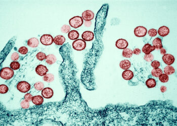 Brote de hantavirus mantiene en alerta a EE.UU.: Un primer positivo y varios casos sospechosos en cuarentena