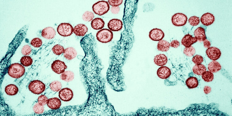 Brote de hantavirus mantiene en alerta a EE.UU.: Un primer positivo y varios casos sospechosos en cuarentena